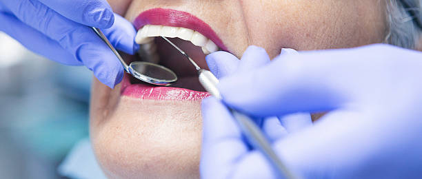 Best Emergency Dental Care for Broken or Chipped Teeth in West Reading, PA